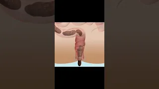 شاهد عملية هضم واخراج الطعام Watch The Process Of Digestion And Excretion Of Food 