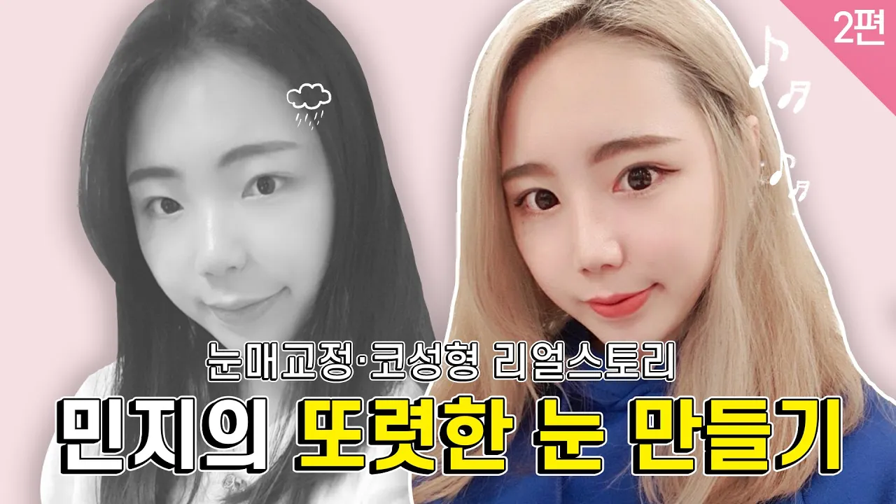미호를 만나고 달라진 워킹맘의 진솔한 이야기[눈/코성형 리얼스토리]