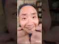 乞丐下山履行婚姻，未婚妻CEO却得寒毒只能活3个月！殊不知小伙竟是绝世神医唯一传人，只一针便让CEO起死回生瞬间康复，首富看穿小伙身手不凡主动献出千亿家产，想要给女儿嫁给他！