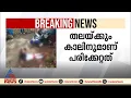 തിരുവനന്തപുരത്ത് ഭാര്യയെ ഭർത്താവ് ചുറ്റിക കൊണ്ട് അടിച്ച് പരിക്കേൽപ്പിച്ചു