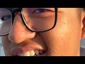 Download Lagu IRL | NGANTER SANDRO KE AMRIK