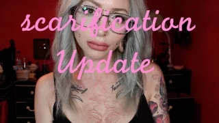 Scarification Gone Wrong 3yr Update