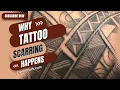 Why Tattoo Scarring Happens-Tattooing For Beginners