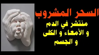 رقية إخراج السحر المشروب من الامعاء و الكلى و حرق خادمه 