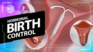 How Every Hormonal Birth Control Method Works