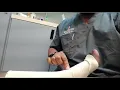 How to adjust compression hose on the ankle and leg that is too tight Dr Isiorho demonstrates