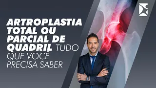 Artroplastia total ou parcial de quadril Tudo que você precisa saber