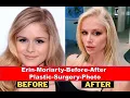 Erin Moriarty Before After Plastic Surgery