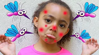 I'm So Itchy Nursery Rhymes Song | More Nursery Rhymes and Children's Songs