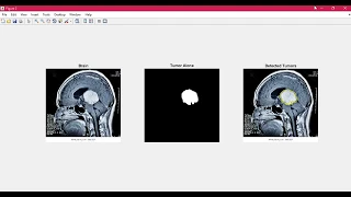 Brain Tumor Detection using Matlab - Image Processing GUI step by step