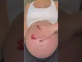 how I am TRYING to prevent stretch marks