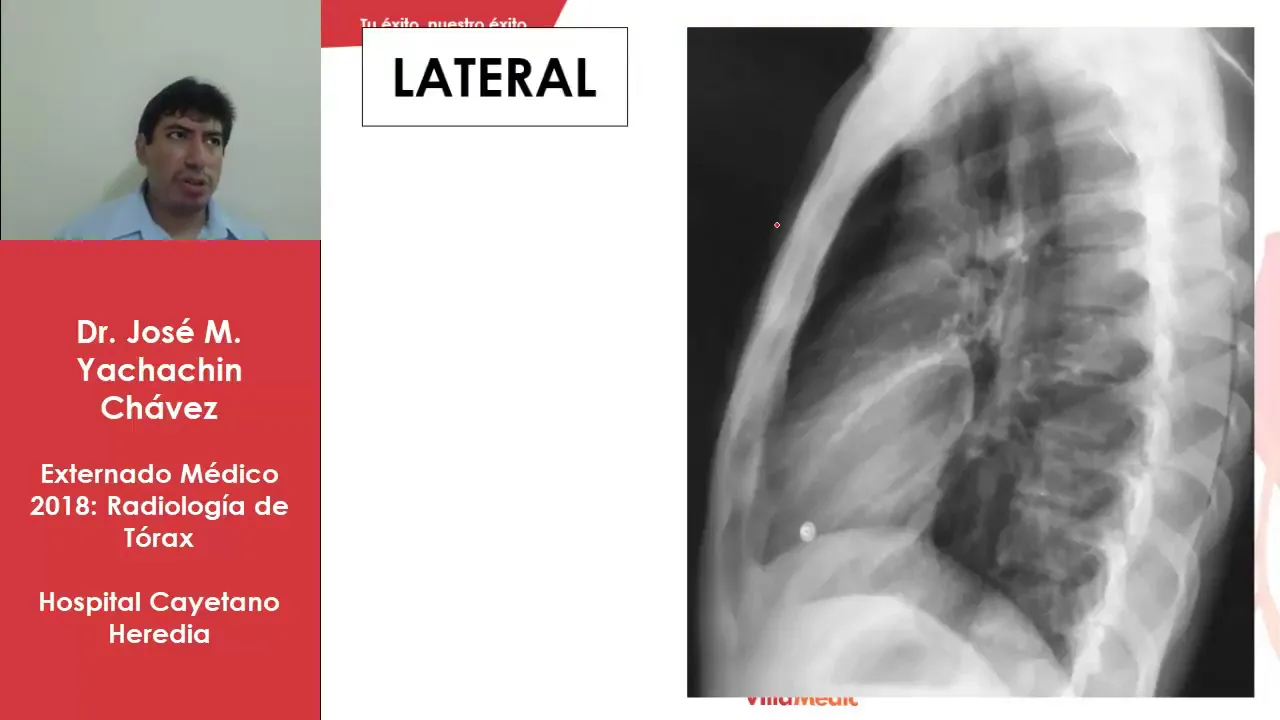 RADIOLOGIA DE TORAX