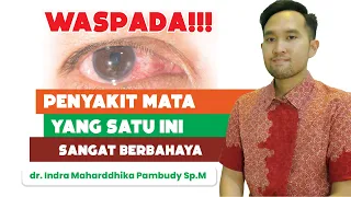 Download BAHAYA KERATITIS (MATA MERAH DAN TERGORES) DAN SOLUSINYA - VIO OPTICAL CLINIC MP3