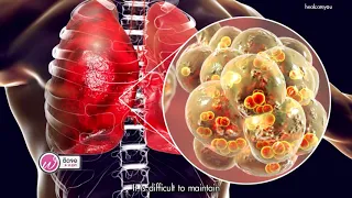 การผ่าตัดเปลี่ยนข้อสะโพกเทียมช่วยผู้ป่วยสูงวัยอย่างไร