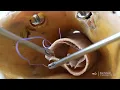 Intracorporeal Omega Stitch in Vaginal Cuff Closure After Hysterectomy