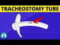 Tracheostomy Tube Medical Definition Quick Explainer
