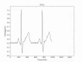 ECG App Plotting