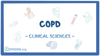 COPD Made Simple: Diagnosis, Exacerbations & Management