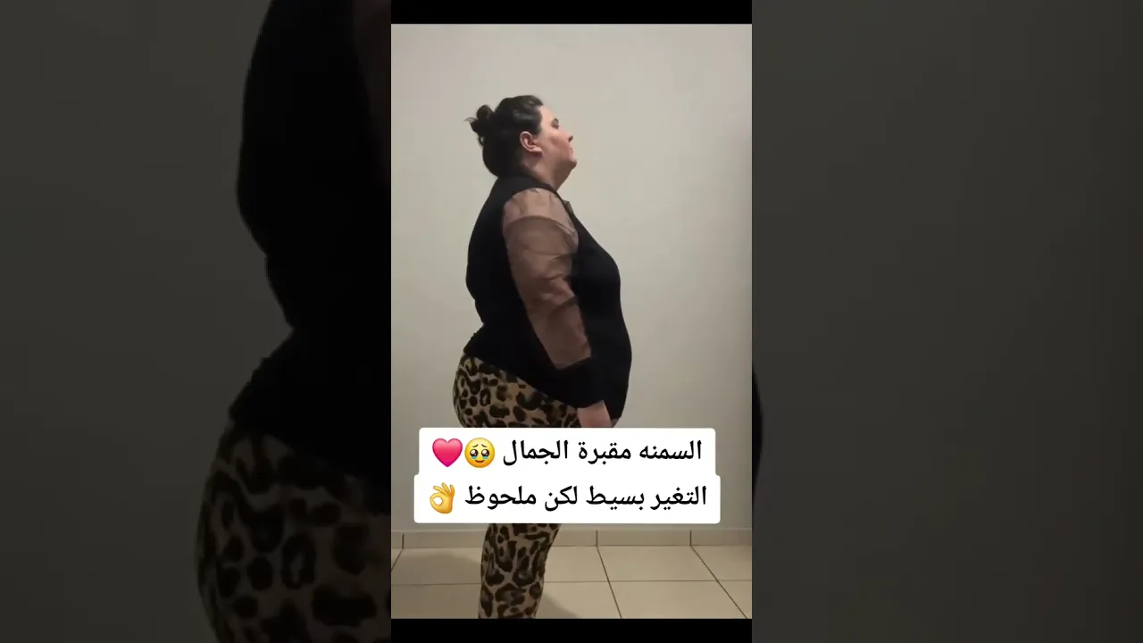 السمنة مقبرة الجمال