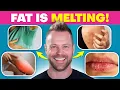 15 WEIRD Signs You’re Burning Fat (Even If the Scale Says You’re Not!)