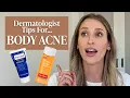 Body Acne or Folliculitis Dermatologist Tips Drugstore Skincare Products to Try Dr Sam Ellis