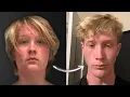 Download Lagu How to ACTUALLY Lose Face Fat (No Bullsh*t Guide)