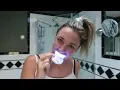 Do at-home teeth whitening kits really work Glam Lab
