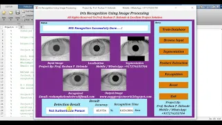 Iris Recognition Using Matlab Source Code Final Year Project IEEE Projects