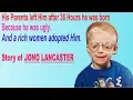 Love me love my face Motivational Story of JONO LANCASTER