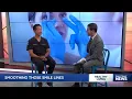 Smoothing Smile Lines with Dr Kim