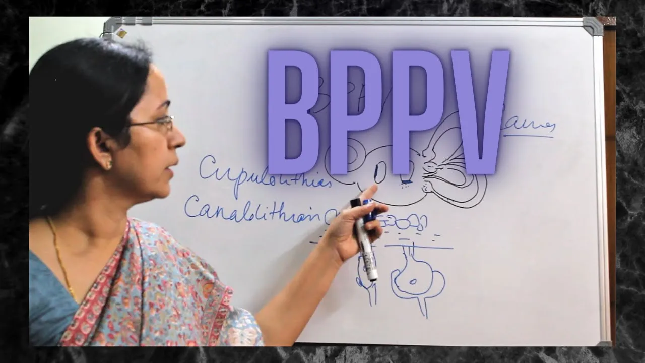 026. Benign Paroxysmal Positional Vertigo  #BPPV