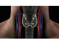 Overview of Parathyroid Disease Causes Symptoms and Treatment for Hyperparathyroidism