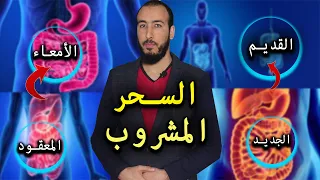 رقية السحر المشروب 