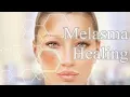 Download Lagu ❉ Heal Melasma! ~ Immaculate + Perfect + Youthful Skin + Rife Frequencies ~ Relaxing Water Sounds
