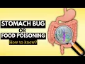 Lagu How to Tell if You Have a Stomach Bug or Food Poisoning: A Complete Guide