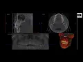 Open Inventor Toolkit Automatic Dental Panoramic