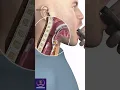 Endotracheal Intubation