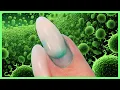 Watch For Hidden In Your Nails