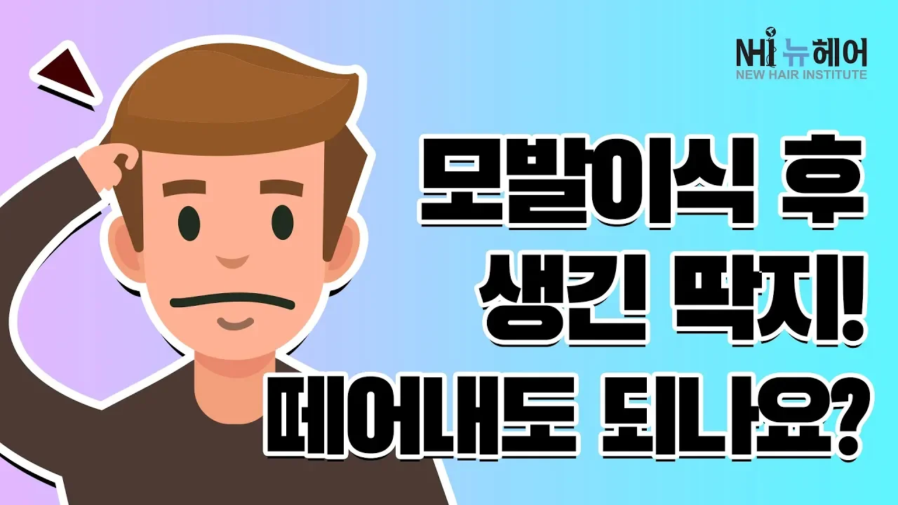 [모발이식][모발이식후기] 모발이식 후 생긴 딱지 떼어내도 되나요? - 뉴헤어 I 모발이식 I 탈모QnA I