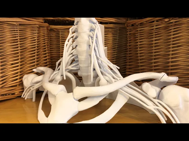 16-Piece Full Size Brachial Plexus Model video thumbnail