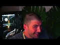 Nickmercs has a dent in his head