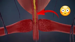 كيف يحدث القذف عند المرأة أثناء الجماع المسار القصير 