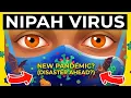 Lagu Nipah-virus: een nieuwe wereldwijde gezondheidscrisis?