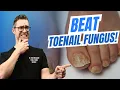 BEST Toenail Fungus Treatment 2024 [+4 BIG SECRETS]