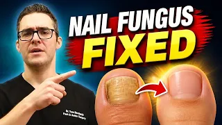 BEST Toenail Fungus Treatment 2024 [+4 BIG SECRETS]