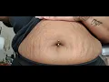 Piercing my belly button BxllaSavagx