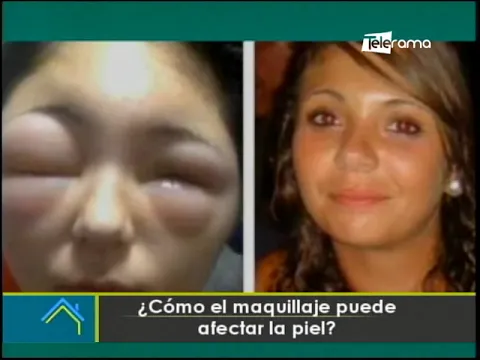 ¿Cómo el maquillaje puede afectar la piel?