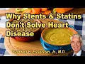 Why stents and statins don t solve heart disease - Caldwell B Esselstyn Jr M D