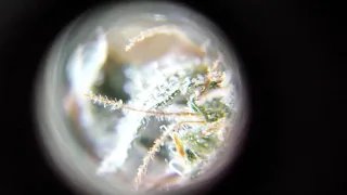 Trichomes Under a LED MicroScope Skunk Wreck Hidden Blue Delights Canadian Girl Grower ages 21