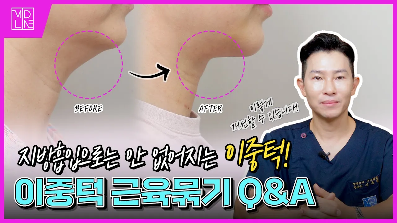 이중턱… 지방흡입만으론 절대 안 되는 이유!😱